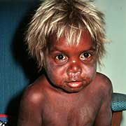 Small Warlpiri boy